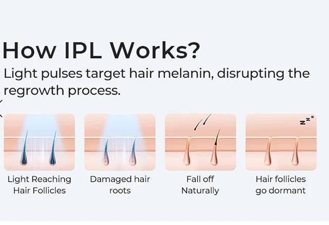 GlowSkin™ Permanent IPL laser Hair Removal