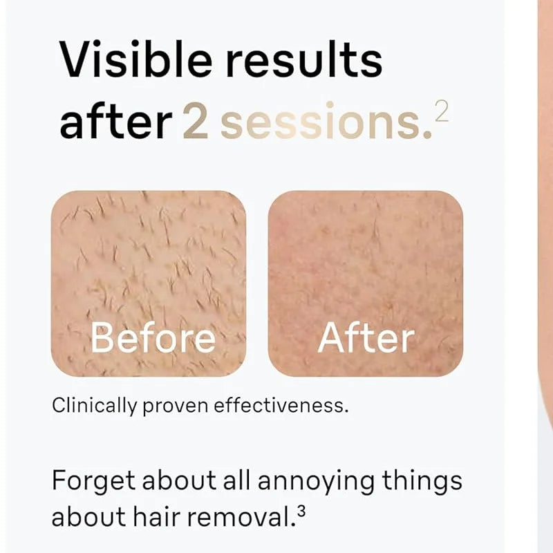 GlowSkin™ Permanent IPL laser Hair Removal